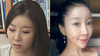 Illustration for article titled Korean Plastic Surgery Is Not What It Seems